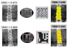 1200 Micro-architettura degradata 1200-1350 Micro-architettura