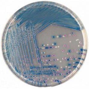 V. VULNIFICUS (INFEZIONE) V. vulnificus è bacillo GRAM-, patogeno opportunista, responsabile del 95% dei decessi conseguenti al consumo di prodotti ittici negli Stati Uniti.