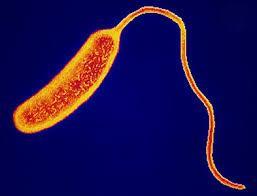 V. CHOLERAE (INFEZIONE ENTEROTOSSICA) V. cholerae è un bacillo GRAM-, agente del colera, forma morbosa caratterizzata da diarrea profusa e vomito.