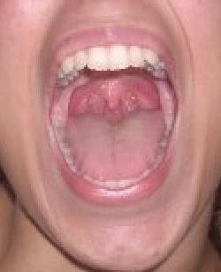 vestibolo della bocca
