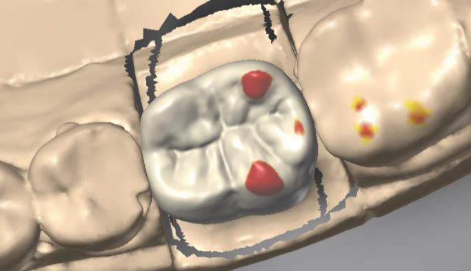 2.4 Catena dentale L utente CARES non deve selezionare manualmente la catena dentale.