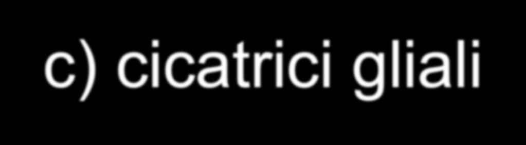 c) cicatrici gliali gli astrociti entrano in gioco quando sopravvengono dei fenomeni che portano a distruzione il tessuto nervoso (processi infiammatori, emorragie, ischemie o neoplasie