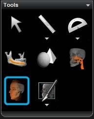 acquisizione CBCT in CS 3D Imaging Software: Il