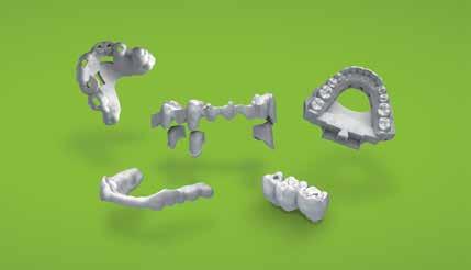 Materiali affidabili e tecnologie all'avanguardia oggi consentono di produrre protesi Straumann eshape dentali in modo molto più efficiente ed economico di un tempo, senza scendere a compromessi in