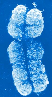 INATTIVAZIONE CROMOSOMA X Processo molecolare selettivo Geni che NON vengono inattivati: 1. XIST stesso, inattivo nel cromosoma che non subisce l inattivazione; 2.