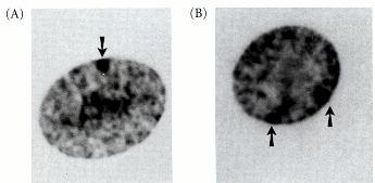 2 Y: il gene è perduto X: produce il doppio di prodotto proteico come conseguenza 1 2 3 La femmina inattiva una copia a caso del gene in ogni cellula 1 2 3 Compensazione delle perdite: i geni perduti