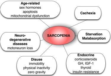 Sarcopenia: eziopatogenesi Muscaritoli M