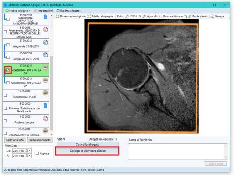 Modifica collegamento a elemento clinico Selezionare l allegato da eliminare e cliccare sul pulsante Collega a