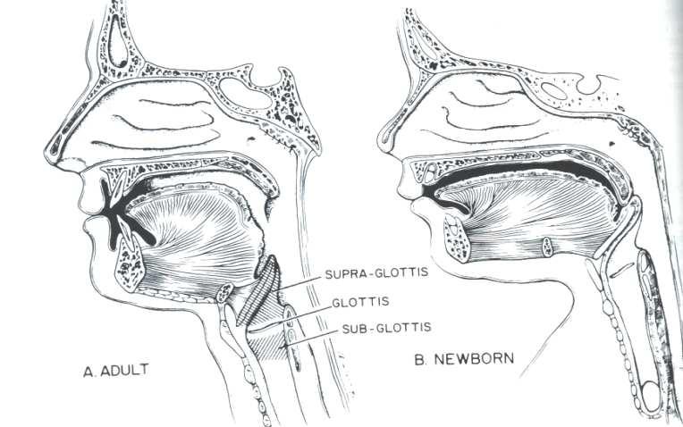 Differenze fra adulto e bambino: Dimensioni 1/3 alla nascita rispetto all adulto Dimensioni più strette di sottoglottide e glottide Sottoglottide è il segmento