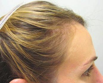 esclusivamente per studiare gli integratori per la crescita dei capelli delle donne.