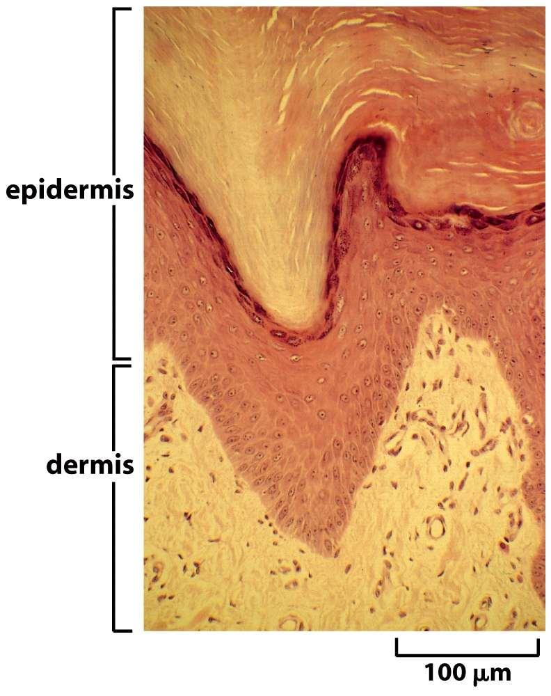 Cresta epidermica