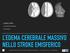 L EDEMA CEREBRALE MASSIVO NELLO STROKE EMISFERICO