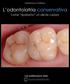L odontoiatria conservativa
