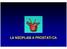 LA NEOPLASIA PROSTATICA