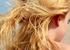 L effetto dei raggi ultravioletti sui capelli e sul cuoio capelluto: dai danni estetici alla caduta dei capelli, ai carcinomi cutanei.