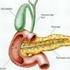 Pancreatite cronica e neoplasia pancreatica intraduttale