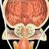 Sorveglianza Attiva nel carcinoma prostatico : CONS