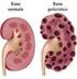 Funzioni dei reni 1 1) I reni regolano la perdita di acqua ed elettroliti dall organismo in modo da mantenere costanti quantità e composizione dei