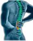PDTA nel mal di schiena: dalla diagnosi all approccio terapeutico.