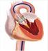 Trattamento percutaneo della stenosi valvolare aortica. Gennaro Santoro. Dipartimento cardiologico e dei vasi Ospedale di Careggi Firenze