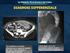 Università degli Studi di Catania DIVERTICOLITE. U.O. di Chirurgia Laparoscopica A.O.U. Policlinico G.Rodolico - Catania. Direttore: Prof. V.