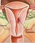 LA DIAGNOSI ECOGRAFICA DELL ENDOMETRIOSI
