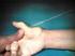 Trattamento chirurgico della artrosi trapezio-metacarpica: confronto fra artrodesi ed artroplastica tendinea
