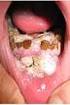 Labbra e cavità orale