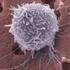 L impiego delle cellule staminali nella patologia neoplastica ematologica