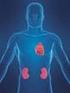 Sindrome Cardiorenale