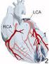 Caso clinico : Infarto miocardico acuto (IMA)