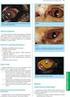 TobraDex 0,3% + 0,1% collirio, sospensione TobraDex 0,3% + 0,1% unguento oftalmico tobramicina e desametasone