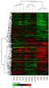 CXCL10/IP10 is a novel potential in vitro marker of TB infection