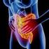 Malattie infiammatorie croniche intestinali (IBD) Rettocolite ulcerosa (CU) Morbo di Crohn (MC) Coliti indeterminate. L eziologia è sconosciuta