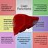Treatment of Liver Diseases