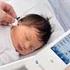 Screening neonatale dei disturbi permanenti dell udito