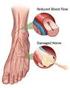 Uptodate sulla Terapia del Dolore Neuropatico