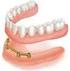 PROTESIZZAZIONE MOBILE (overdenture)