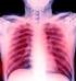 L ecografia polmonare