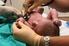 LA TERAPIA INTENSIVA NEONATALE: un posto sicuro per la chirurgia neonatale?