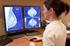 Diagnosi precoce e screening mammografico