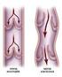 Varici(arti inferiori, esofagee, emorroidarie) Trombosi venose (superficiali, profonde) Insufficienza venosa cronica