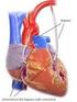 Tra cardiopatia ischemica e malattia coronarica