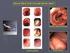 La diagnosi dell infezione da Helicobacter pylori: raccomandazioni dal Maastricht Consensus Report