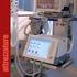 Apparecchio per ventilazione domiciliare e ospedaliera. Adulti, Bambini, Neonati di peso > 3Kg. Grafici temporali: pressione, volume, flusso