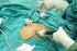 L ISTERECTOMIA OGGI: TECNICHE A CONFRONTO. Isterectomia robotica nell utero voluminoso