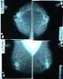 Tecnica di esecuzione e dosimetria dell'esame mammografico in pazienti portatrici di protesi mammaria: La Survey. in Regione Emilia Romagna