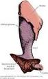 Barre sacrali. Fissazione della pelvi posteriore in caso di fratture o lussazioni dell articolazione sacro-iliaca.