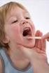 La faringotonsillite e l otite media acuta in età pediatrica