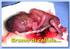 Malformazioni del feto, ancora no all'aborto eugenetico Cassazione - Sezione terza civile - sentenza 16123/06 Commento di Mauro Fusco